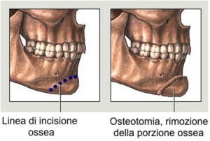Senza nome-5